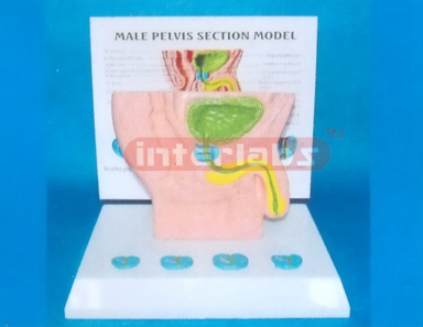 HUMAN MALE HEALTH DISEASE COMPOSITION MODEL OF GENITAL ORGANS BLADDER, PROSTATE AND URETHRA